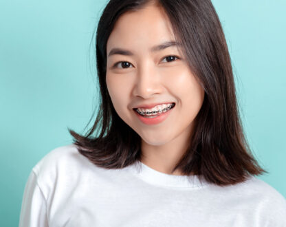 What You Need To Know Before Getting Dental Braces