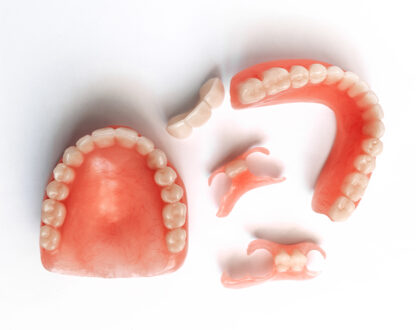 Model of dentures prepared by dentist in Markham, ON.