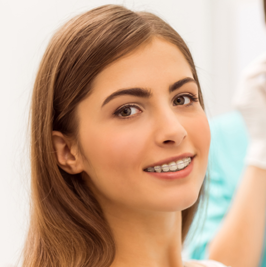 Dental Braces
