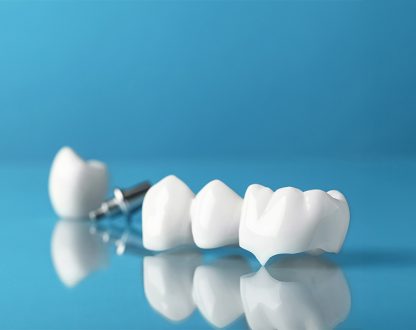 Half My Tooth Broke Off: Is a Dental Crown the Right Solution?